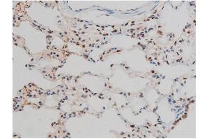 Immunohistochemistry (IHC) image for anti-GATA Binding Protein 1 (Globin Transcription Factor 1) (GATA1) (pSer142) antibody (ABIN6254982)