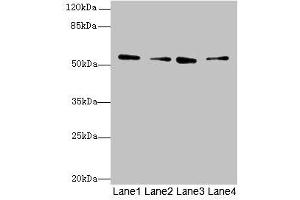 Western blot All lanes: ERO1B antibody at 3. (ERO1LB 抗体  (AA 101-400))