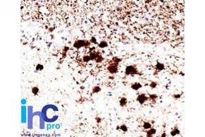 Formalin-fixed, paraffin-embedded human brain stained with Pgp9. (UCHL1 抗体)