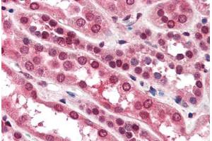 Human Kidney (formalin-fixed, paraffin-embedded) stained with ZNF292 antibody ABIN364490 at 10 ug/ml followed by biotinylated goat anti-rabbit IgG secondary antibody ABIN481713, alkaline phosphatase-streptavidin and chromogen. (ZNF292 抗体)