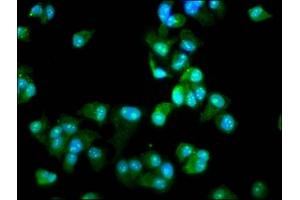 Immunofluorescence staining of MCF-7 cells with ABIN7142656 at 1:66, counter-stained with DAPI. (DCLRE1B 抗体  (AA 345-493))
