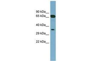 Image no. 1 for anti-Glyoxalase Domain Containing 4 (GLOD4) (AA 143-192) antibody (ABIN6741898) (GLOD4 抗体  (AA 143-192))
