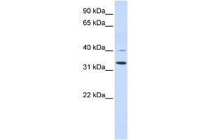 WB Suggested Anti-CRYZ Antibody Titration:  0. (CRYZ 抗体  (Middle Region))