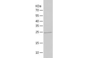 Western Blotting (WB) image for Asialoglycoprotein Receptor 2 (ASGR2) (AA 80-311) protein (His tag) (ABIN7285085) (Asialoglycoprotein Receptor 2 Protein (ASGR2) (AA 80-311) (His tag))