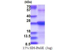 SDS-PAGE (SDS) image for Stromal Cell Derived Factor 2 (SDF2) (AA 19-211) protein (His tag) (ABIN5853737) (SDF2 Protein (AA 19-211) (His tag))