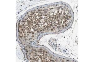 Immunohistochemical staining of human testis with ENTPD7 polyclonal antibody  shows moderate nuclear and cytoplasmic positivity in cells in seminiferus ducts at 1:20-1:50 dilution.