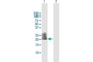 Western Blot analysis of CD160 expression in transfected 293T cell line by CD160 MaxPab polyclonal antibody. (CD160 抗体  (AA 1-181))