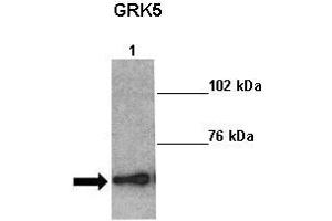 Sample Type: Lane 1:241 µg mouse left ventricle heart lysate Primary Antibody Dilution: 1:0000Secondary Antibody: Anti-rabbit-HRP Secondary Antibody Dilution: 1:0000 Color/Signal Descriptions: GRK5  Gene Name: Kathleen Gabrielson Submitted by: (GRK5 抗体  (Middle Region))