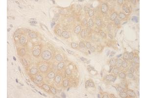 Immunohistochemistry (IHC) image for anti-SFRS Protein Kinase 2 (SRPK2) (AA 425-475) antibody (ABIN7449028) (SRPK2 抗体  (AA 425-475))