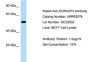 Western Blotting (WB) image for anti-Golgi Reassembly Stacking Protein 2, 55kDa (GORASP2) (C-Term) antibody (ABIN2789010) (GORASP2 抗体  (C-Term))