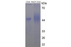 Image no. 3 for Procollagen II C-Terminal Propeptide (PIICP) (C-Term) peptide (Ovalbumin) (ABIN5666350)