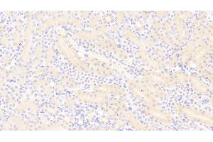 DAB staining on IHC-P;Samples: Mouse Kidney Tissue;Primary Ab: 20μg/ml Rabbit Anti-Mouse PDGFBB Antibody. (PDGF-BB Homodimer (AA 21-241) 抗体)
