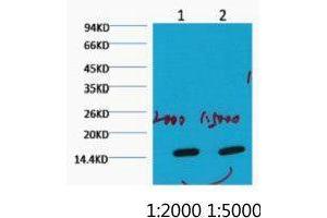 Western Blot (WB) analysis of HeLa, diluted at 1) 1:2000 2) 1:5000. (COX IV 抗体)