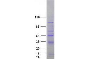 Validation with Western Blot (STK19 Protein (Transcript Variant 1) (Myc-DYKDDDDK Tag))