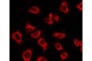 ABIN6269373 staining Hela by IF/ICC. (MAPK14 抗体)