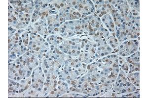 Immunohistochemistry (IHC) image for anti-Glutamate Decarboxylase 1 (Brain, 67kDa) (GAD1) antibody (ABIN2721536)