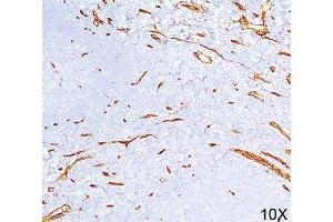 IHC testing of human tonsil (10X) stained with CD34 antibody (QBEnd/10). (CD34 抗体)