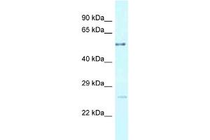 WB Suggested Anti-ENTPD3 Antibody Titration: 1.