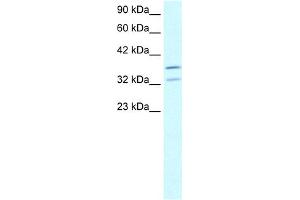 WB Suggested Anti-FOXL1 Antibody Titration:  2. (FOXL1 抗体  (N-Term))