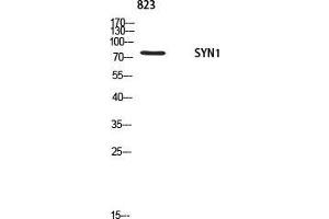 Western Blot (WB) analysis of 823 using SYN1 antibody. (SYN1 抗体)