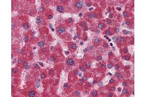 Immunohistochemistry (IHC) image for anti-Methylenetetrahydrofolate Dehydrogenase (NADP+ Dependent) 1, Methenyltetrahydrofolate Cyclohydrolase, Formyltetrahydrofolate Synthetase (MTHFD1) (AA 863-912) antibody (ABIN6747103)