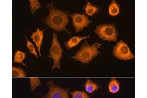 Immunofluorescence analysis of L929 cells using RIG-I / DDX58 Polyclonal Antibody at dilution of 1:100. (DDX58 抗体)