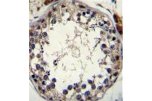 Formalin fixed and paraffin embedded human testis tissue stained with STRA8 Antibody (C-term) followed by peroxidase conjugation of the secondary antibody and DAB staining. (STRA8 抗体  (C-Term))