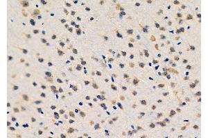 ABIN6261721 and ABIN6276601 at 1/100 staining Mouse brain tissue by IHC-P. (FGF10 抗体  (C-Term))