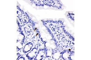 IHC analysis of Peptide YY using anti-Peptide YY antibody (ABIN4886709). (Peptide YY 抗体  (Middle Region))