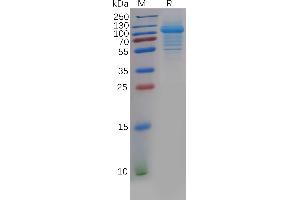 SDS-PAGE (SDS) image for Interleukin 5 Receptor, alpha (IL5RA) (AA 21-338) protein (Fc Tag) (ABIN7092703)