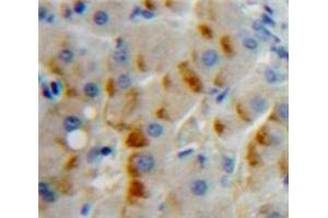 IHC-P analysis of Liver tissue, with DAB staining. (CD79b 抗体  (AA 26-225))