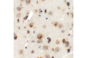 Immunohistochemical staining of mouse brain cells with AP3B2 polyclonal antibody  at 5 ug/mL. (AP3B2 抗体  (N-Term))
