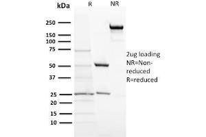 SDS-PAGE Analysis Purified ACTH Monoclonal Antibody (57). (POMC 抗体  (N-Term))