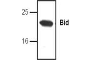 Image no. 1 for anti-BH3 Interacting Domain Death Agonist (BID) antibody (ABIN127033) (BID 抗体)