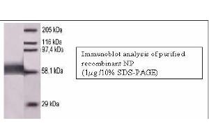 Image no. 1 for anti-Measles Virus Nucleoprotein (MV N) antibody (ABIN346974) (Measles Virus Nucleoprotein (MV N) 抗体)