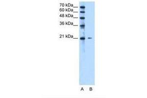 Image no. 1 for anti-Chromosome 20 Open Reading Frame 24 (C20ORF24) (N-Term) antibody (ABIN321585) (C20ORF24 抗体  (N-Term))