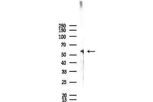 Western blot analysis of lysates from Rat lung, using Cytochrome P450 4F8 Antibody at 1/1000 dilution.