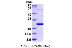 SDS-PAGE (SDS) image for Thyroid Hormone Responsive (THRSP) (AA 1-146) protein (His tag) (ABIN5853002)