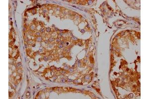 Immunohistochemistry (IHC) image for anti-Solute Carrier Family 6 (Neurotransmitter Transporter, serotonin), Member 4 (SLC6A4) antibody (ABIN7127804)