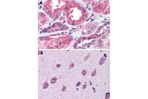 Immunohistochemical staining of formalin-fixed, paraffin-embedded human kidney (A) and human brain, cortex (B) tissue after heat-induced antigen retrieval. (IGSF8 抗体  (Internal Region))
