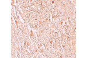 Immunohistochemistry (IHC) image for anti-Pigeon Homolog (PION) (C-Term) antibody (ABIN1030587) (GSAP 抗体  (C-Term))