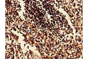 Immunohistochemistry of paraffin-embedded human spleen tissue using ABIN7152137 at dilution of 1:100 (EIF2AK1 抗体  (AA 1-86))