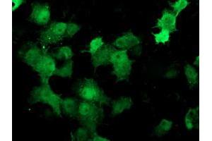 Image no. 2 for anti-Deoxythymidylate Kinase (Thymidylate Kinase) (DTYMK) antibody (ABIN1497923) (DTYMK 抗体)