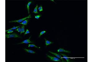 Immunofluorescence of purified MaxPab antibody to HSD17B10 on HeLa cell. (HSD17B10 抗体  (AA 1-261))