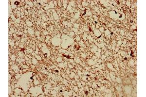 Immunohistochemistry of paraffin-embedded human brain tissue using ABIN7173087 at dilution of 1:100 (TMEM161B 抗体  (AA 1-487))