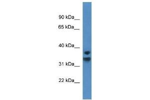 Western Blotting (WB) image for anti-Nuclear Factor of kappa Light Polypeptide Gene Enhancer in B-Cells Inhibitor, delta (NFKBID) (C-Term) antibody (ABIN926561)