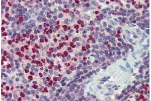 Spleen, Human: Formalin-Fixed, Paraffin-Embedded (FFPE) (FCHO1 抗体  (AA 468-517))
