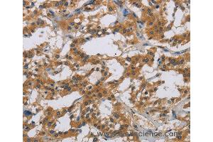 Immunohistochemistry of Human brain  using IL18R1 Polyclonal Antibody at dilution of 1:40 (IL18R1 抗体)