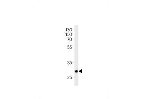 DANRE hoxc9a Antibody (C-term) Azb10016a western blot analysis in zebra fish brain tissue lysates (35 μg/lane). (HOXC9 抗体  (C-Term))