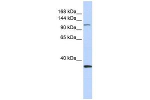 MCM2 antibody used at 1 ug/ml to detect target protein. (MCM2 抗体  (Middle Region))